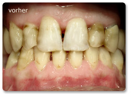 Beispiel Gesamtsanierung