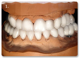 Beispiel gesamtsanierung