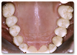 Beispiel gesamtsanierung