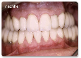 Beispiel gesamtsanierung