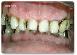 Beispiel Gesamtsanierung