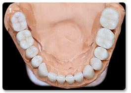 Beispiel gesamtsanierung