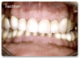 Beispiel gesamtsanierung