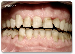 Beispiel Gesamtsanierung