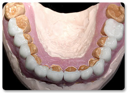 Beispiel gesamtsanierung