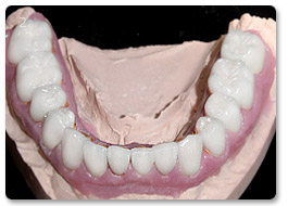 Beispiel gesamtsanierung