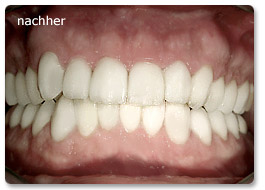 Beispiel gesamtsanierung