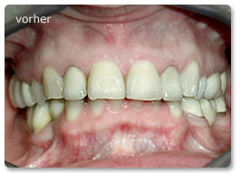 Beispiel Gesamtsanierung