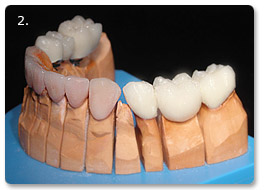 Beispiel gesamtsanierung