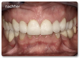 Beispiel gesamtsanierung