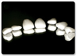 Beispiel Vollkeramik