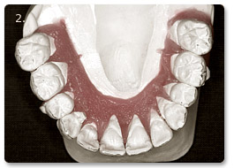 Beispiel Zahnregulierung